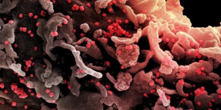 Nuevo estudio revela que el cambio climático podrí­a desencadenar la próxima pandemia