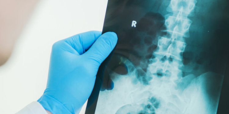 Obligan a los médicos británicos preguntar a los hombres si están en embarazo