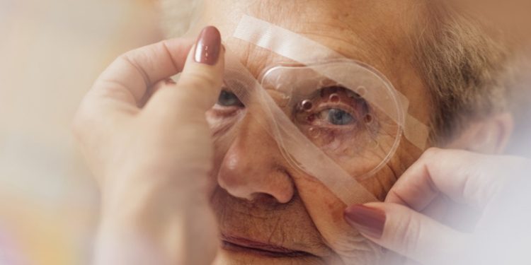 Ocho personas pierden un ojo tras una infección en una serie de cirugías de cataratas en Brasil
