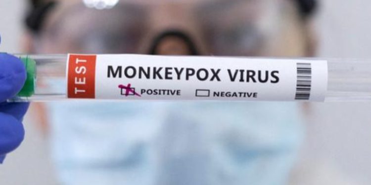 OMS cambia el nombre a la viruela del mono: ahora se llama mpox