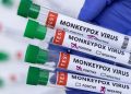 OMS elimina la distinción de endemia para la viruela del mono