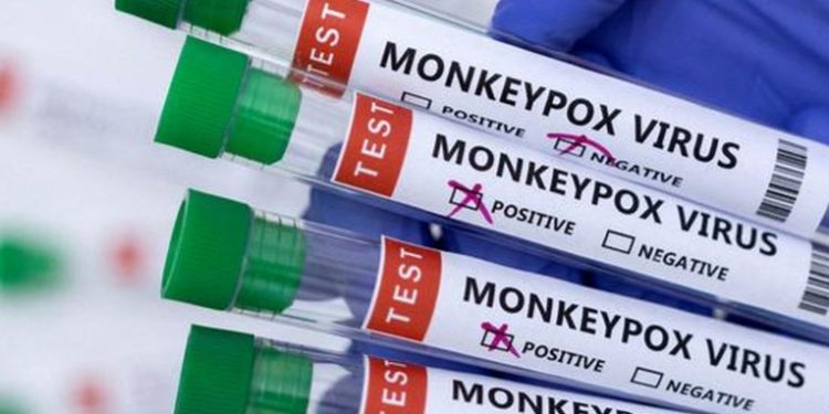 OMS elimina la distinción de endemia para la viruela del mono