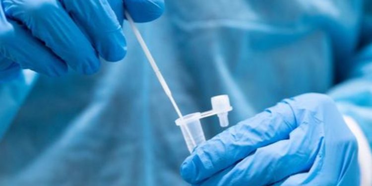 OPS advierte que la pandemia continúa, pero deja a cada paí­s su manejo