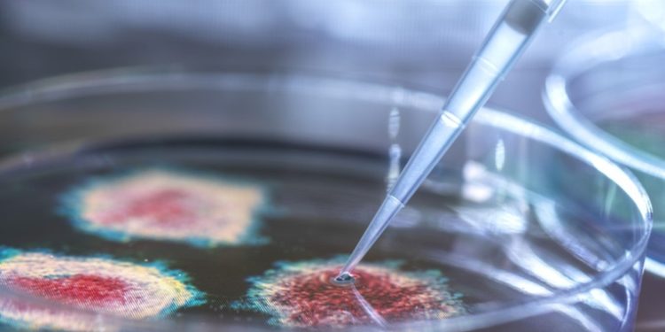 Perú reporta 505 casos de viruela del mono y el Gobierno evalúa comprar vacunas