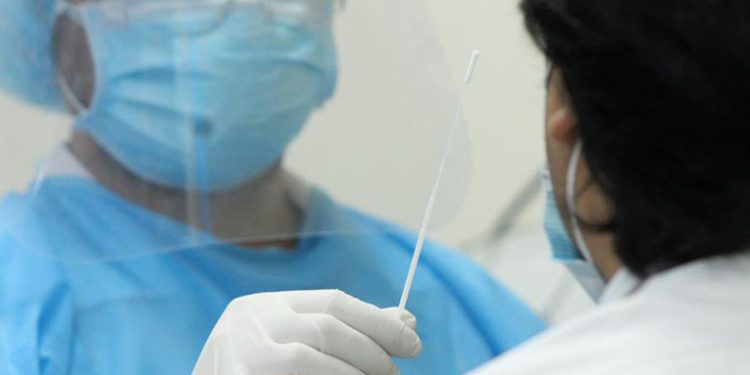 Población con problemas para realizarse la prueba de Covid