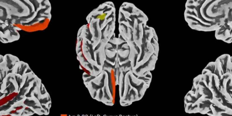 Premian a puertorriqueño por descubrir persistencia de COVID