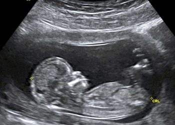 Presentan reforma para impedir la legalización del aborto en Honduras