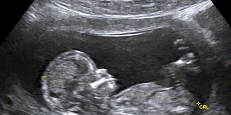 Presentan reforma para impedir la legalización del aborto en Honduras