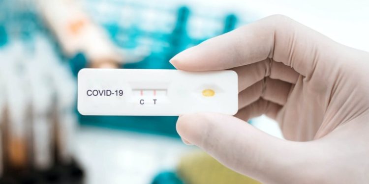 Pruebas de antígeno para detectar el Covid-19 son donadas desde Japón