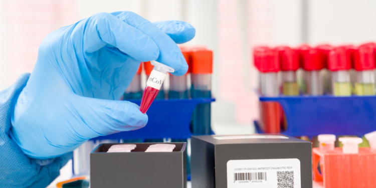 Pruebas de coronavirus han aumentado en fiestas navideñas