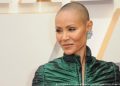 Â¿Qué es la alopecia areata? Causas de la enfermedad y lo que ha dicho Jada Pinkett Smith al respecto