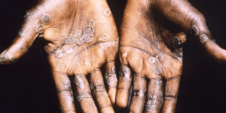 Refuerzan control epidemiológico en fronteras del paí­s