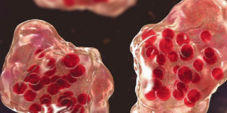 Salud Pública Refuerza Fronteras con Cordón Sanitario para Prevenir Sarampión