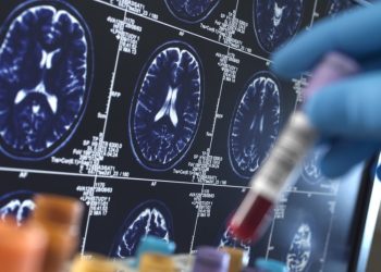 Seis enfermeras de la misma planta de un hospital fueron diagnosticadas de tumores cerebrales a la vez