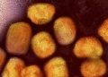 Suecia reporta primer caso de variante más peligrosa de mpox