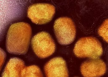 Suecia reporta primer caso de variante más peligrosa de mpox