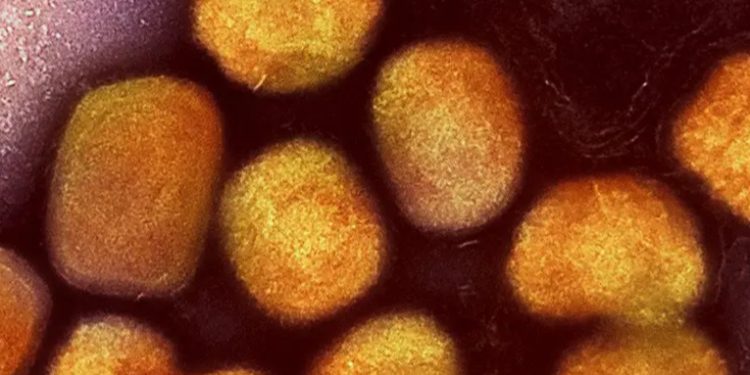 Suecia reporta primer caso de variante más peligrosa de mpox