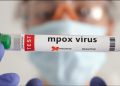 Tailandia registra primer caso de nueva variante de la mpox