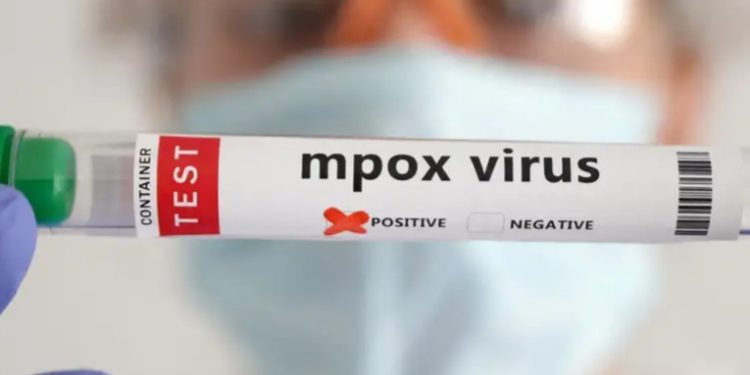 Tailandia registra primer caso de nueva variante de la mpox