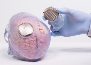 Un rival de Neuralink completa el primer implante humano de interfaz cerebro-ordenador en EE.UU.
