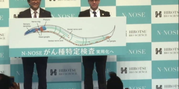 Una compañí­a japonesa utiliza gusanos para detectar el cáncer