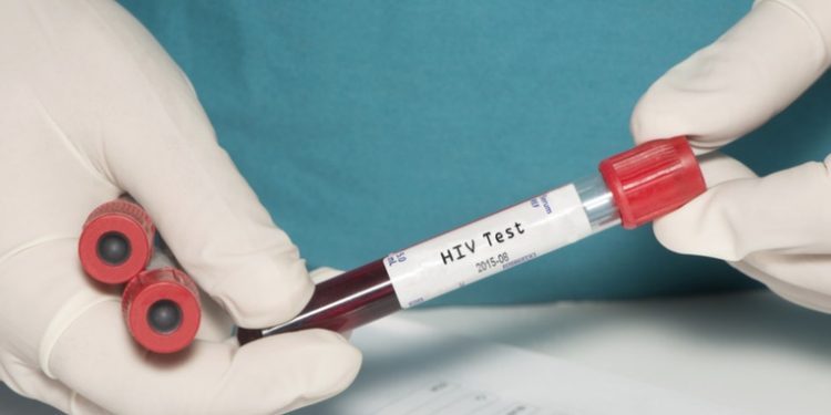 Una mujer en España se convierte en un caso único de curación funcional del VIH y abre nuevas vías de investigación