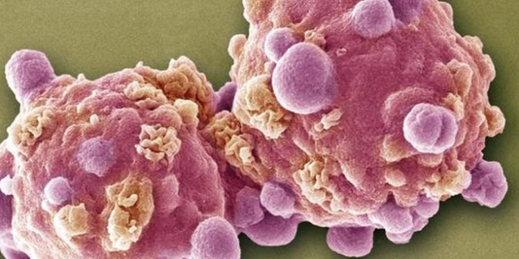 Una pastilla experimental logra remitir la leucemia avanzada en 18 pacientes