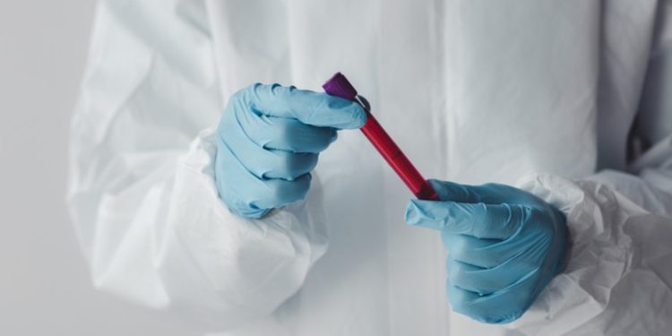 Una persona muere en EE.UU. por un virus que hace sangrar los ojos