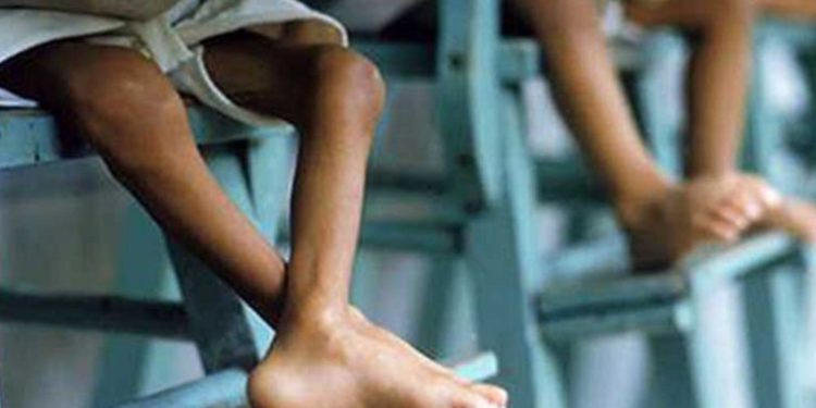 UNICEF confirma que el 47% de niños guatemalteca sufre desnutrición crónica