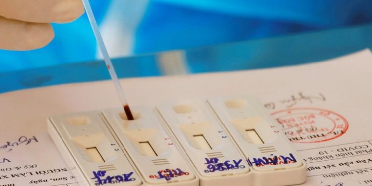 Vietnam detecta una nueva variante de covid-19