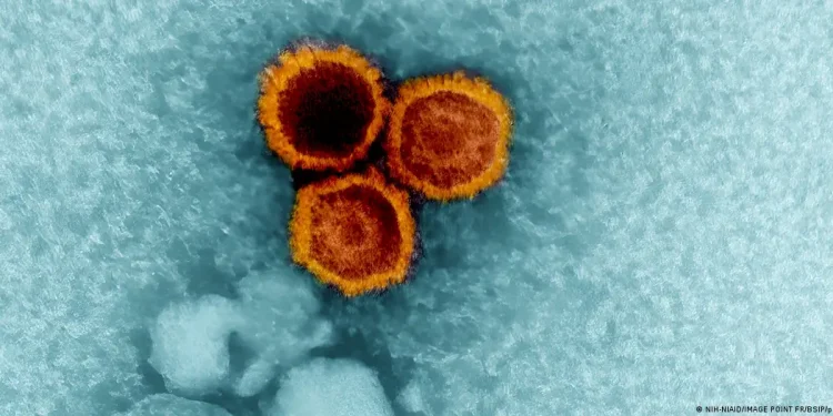 Virus Epstein-Barr y lupus