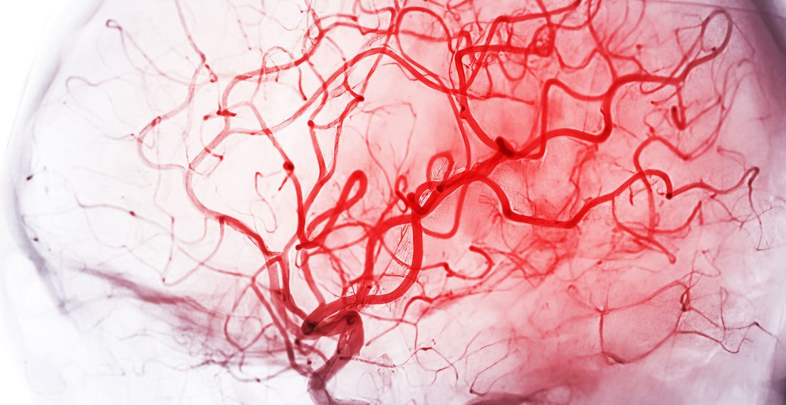 Demencia y flujo sanguíneo