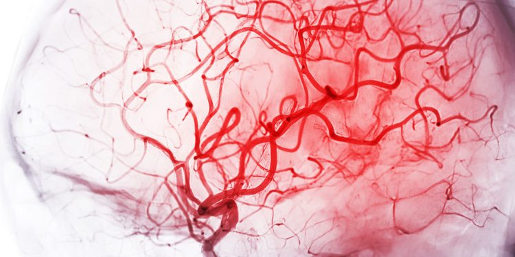 Demencia y flujo sanguíneo